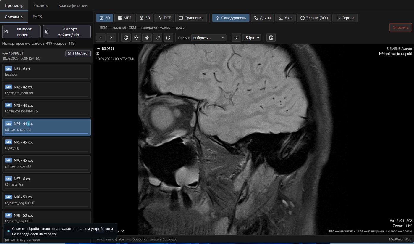 MedVisor Web — просмотр МРТ в браузере